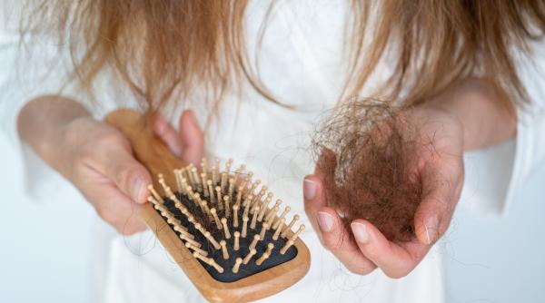 "De ce ne cade părul de la stres?" Un nou studiu a găsit răspunsul la întrebare. Ce este "alopecia areata" şi cum se "activează"