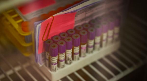 Ministerul Sănătăţii anunţă teste gratuite pentru hepatita B şi C la persoane cu simptome sugestive, cu asigurare sau fără