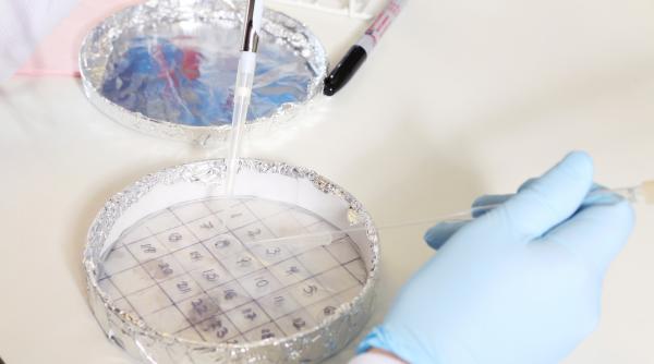 Zeci de paciente cu cancer la sân din Germania au fost tratate greşit, pentru că un medic a interpretat greșit probele de țesut