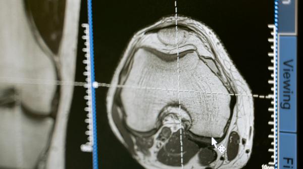 studiul care scaneaza creierul celor mai buni copii si tineri din romania vedem toate ariile creierului
