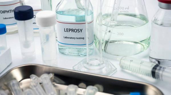 al doilea caz de lepra a fost confirmat la cluj napoca alte doua persoane sunt inca sub evaluare medicala