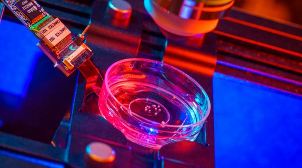 Prevenție inteligentă prin analiza genetică avansată