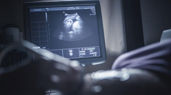 o femeie a ramas din nou insarcinata in timp ce era deja gravida a fost un soc