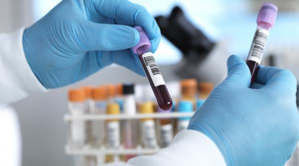 India încearcă să limiteze răspândirea virusului Nipah. Rata mortalității e de 80%, nu există vaccin sau tratament