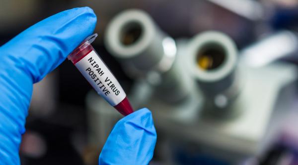 un expert din marea britanie face apel la vigilenta dupa ce virusul mortal nipah a fost detectat in india