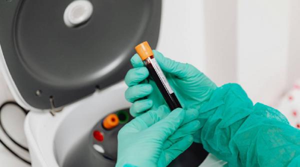 ce este mitocondria si cum o mentinem sanatoasa nu actioneaza singura ci este influentata de intreg organismul