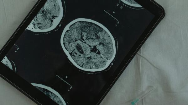 tehnologia de ultima generatie aduce neurochirurgia la un nou nivel la timisoara