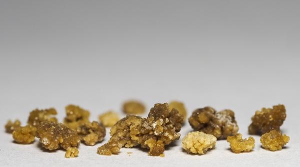 patania unor hoti din italia care au crezut ca au furat o cutie cu pepite de aur erau de fapt pietrele la rinichi ale proprietarului