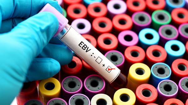 virusul pe care 95 dintre oameni il vor avea toata viata