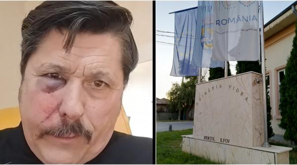„Au dat cu ură, să mă omoare”. Un consilier local AUR a ajuns la spital cu fractură facială după ce a fost bătut în ședința de consiliu