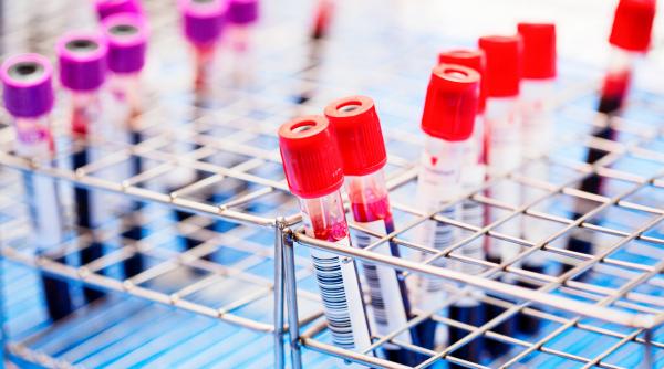 Cercetărorii încearcă să transforme tehnologia transfuziilor într-un vaccin împotriva cancerului 