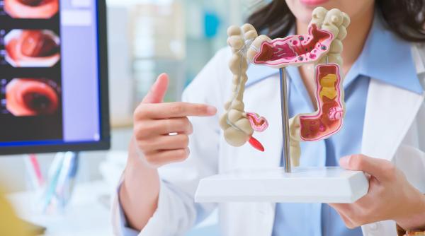 de ce tot mai multi tineri fac cancer de colon in unele tari a devenit principala cauza de deces oncologic la pacienti sub 50 de ani