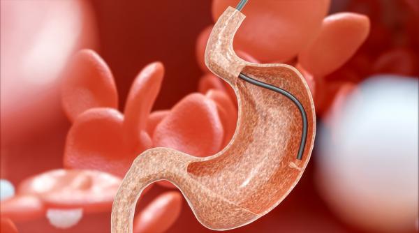 gastrologia explicata simplu ce boli trateaza si cum te poate ajuta