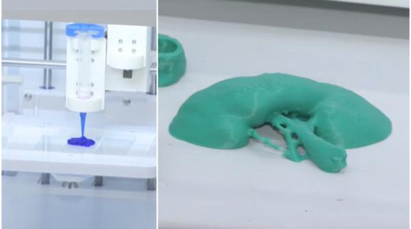 organe printate 3d si pansamente care vindeca pe loc cercetatorii romani revolutioneaza medicina se printeaza un rinichi chiar acum