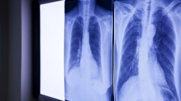 medicii socati de ce au gasit in abdomenul unui barbat care s a prezentat la urgente cu dureri severe e de peste 20 de ani acolo