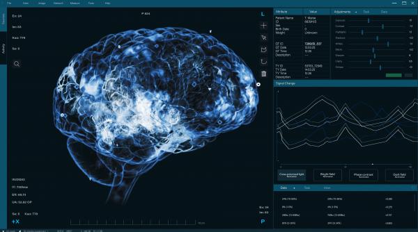 solutii noi de tratament pentru pacientii cu scleroza multipla mult mai prietenos si mult mai confortabil pentru pacient