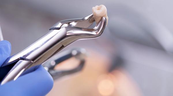 a intrat in coma dupa o banala extractie dentara iar cand s a trezit vorbea doar limbi straine mi am uitat limba materna