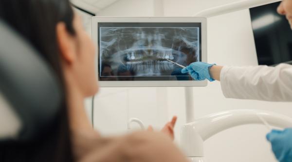 implant dentar sau punte dentara cum sa faci alegerea corecta