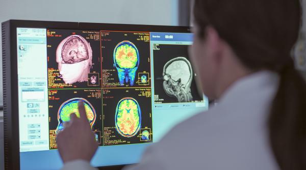 apel in sprijinul pacientilor cu neurofibromatoza de tip 1 diagnostic fara intarzieri tratament fara intreruperi