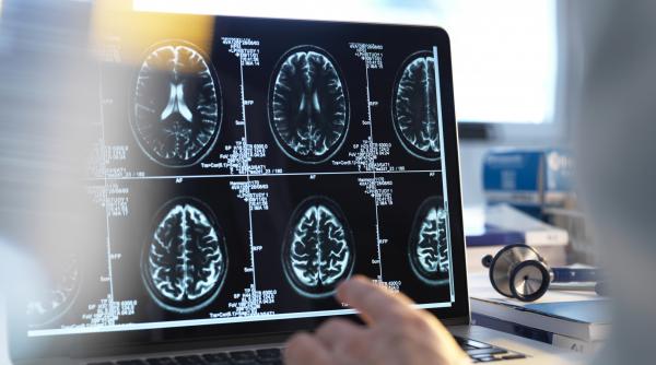un barbat complet paralizat reuseste sa comunice datorita unui cip implantat in creier