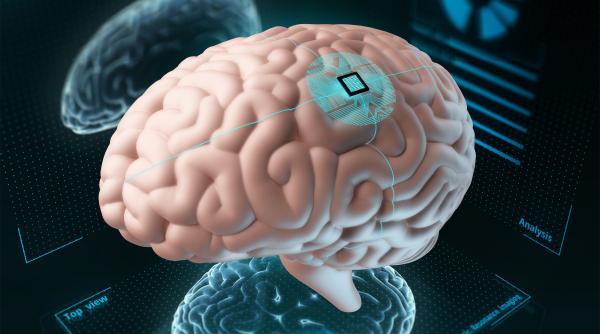 paradromics rivalul lui elon musk in domeniul implanturilor cerebrale a implantat pentru prima oara un cip in creier