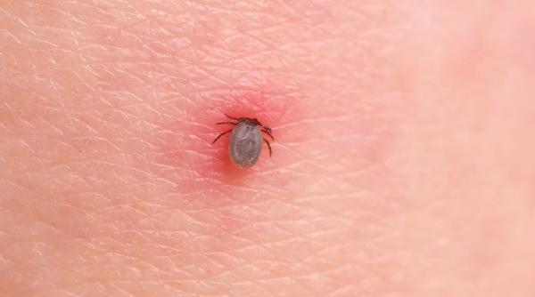cum ajung capusele pe noi cat dureaza pana musca si cum se poate preveni imbolnavirea