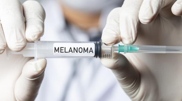 vesti bune pentru pacientii cu cancer de piele moderna si merck au anuntat primele rezultate ale vaccinului impotriva melanomului
