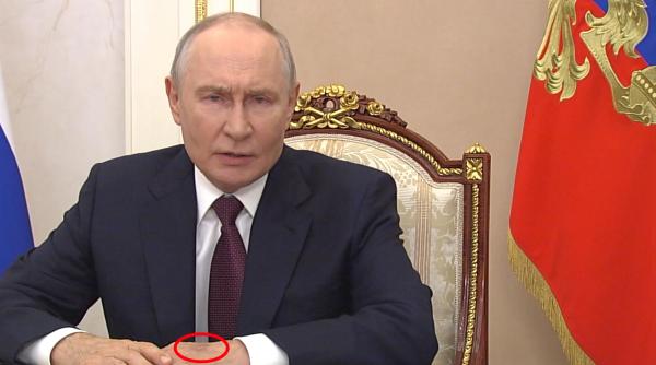 moscow times o pata misterioasa de culoare inchisa a fost vazuta pe mana lui putin si ar putea fi dupa o injectie facuta neglijent