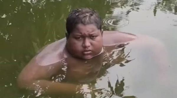 un baiat de 16 ani din india a trait in ultimii cinci ani in apa avea dureri crunte de cate ori iesea