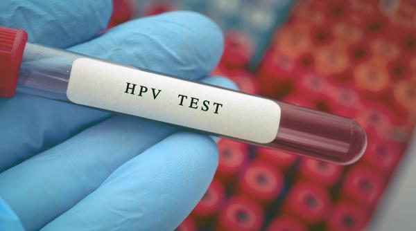 care sunt semnele infectiei cu hpv si barbatii pot dezvolta leziuni precanceroase