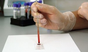 Noul coronavirus ar afecta întâi sângele - studiu