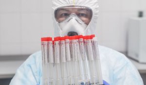 Un medic din China s-a trezit din comă cu pielea mai închisă la culoare, din cauza coronavirusului