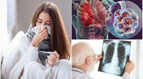Gripa de tip A continuă să creeze probleme în toată țara. Cum ne dăm seama că avem acest virus și ce complicații pot apărea