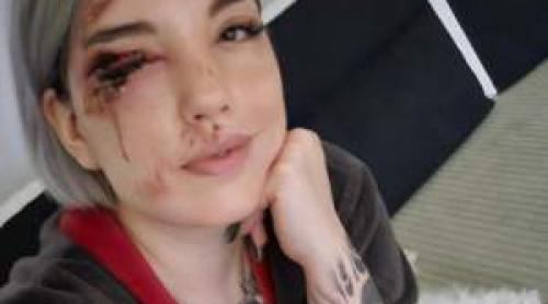 O influenceriță din România a șocat Internetul! A apărut mutilată! Ce a pățit