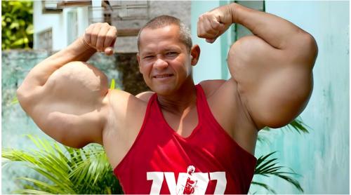 Povestea de viață impresionantă a lui ”Popeye”, culturistul care a murit la 55 de ani. Ce și a injectat în mușchi