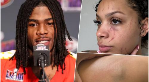 Sportivul celebru care a fost acuzat de violență domestică! Fosta iubită a publicat imagini cu vânătăile și rănile suferite