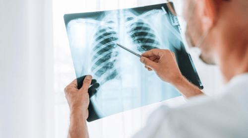 Zeci de radiologi din spitalele de stat „își vând” parafele clinicilor private. Cum sunt înşelaţi pacienţii