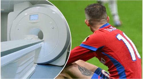 Care e starea lui Florin Tănase după o nouă accidentare la FCSB: “Ar trebui să luăm deja un RMN portabil la câte a făcut!”