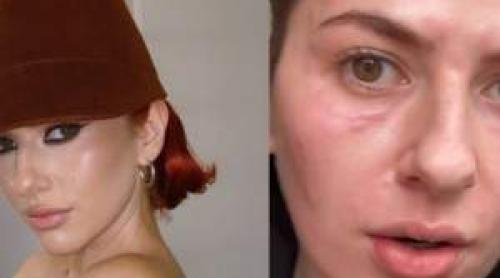 Lidia Buble i a șocat pe fani! Fața artistei este de nerecunoscut: „Zici că mă transform într o reptilă”