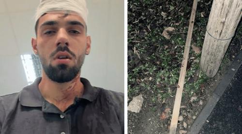 Mai mulți fotbaliști de la Poli Timișoara, acuzați că au bătut cu bestialitate un adolescent de 19 ani. „Dacă avea cu câteva kilograme mai puţin, îi măturam creierii de pe asfalt”