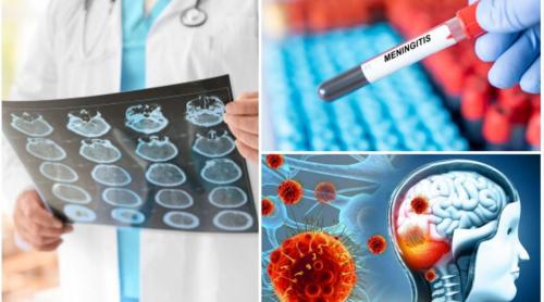 Focar de meningită. Care este riscul de răspândire în Europa, după explozia de cazuri din Marea Britanie