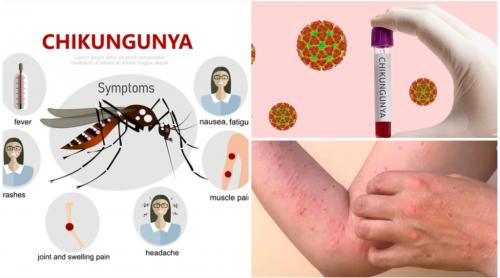 Un virus tropical care provoacă epidemii, tot mai aproape de Europa. Simptomele infecției cu chikungunya