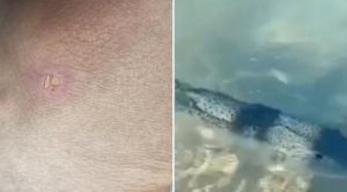 Primul român atacat de peştele iepure. Turiştii au filmat cum vânează turişti, la mal
