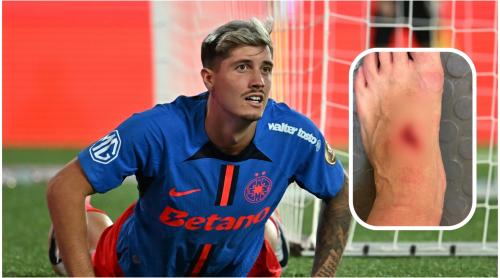 David Miculescu, out în derby ul cu U Craiova? Cum arată piciorul căpitanului FCSB după accidentarea din meciul cu Petrolul