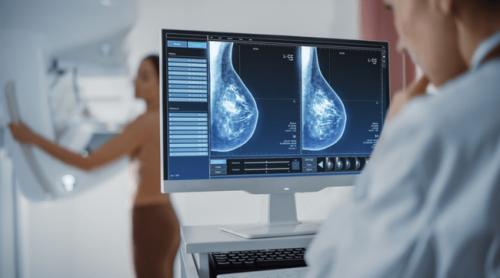 Femeile născute între 1966 și 1996 ar putea preveni cancerul de sân renunțând la două obiceiuri frecvente
