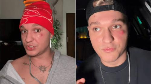 Influencerul Louis Florea, de urgență la spital! Avertismentul care l a speriat: „S ar putea răspândi spre creier”