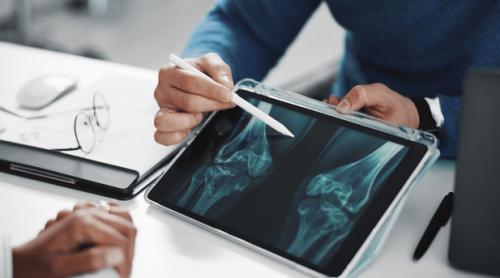 Medici: Probabil cel mai bun aliment pentru oase puternice