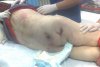 Imagini şocante. Cum arată o pacientă &quot;îngrijită” într-un spital din Constanţa 92949