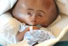 Şansă la o viaţă normală: Fetiţa cu capul &quot;de extraterestru&quot; a fost operată cu succes, în India 208076