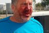 Un antrenor din Liga a IV-a Giurgiu a fost umplut de sânge de rudele unui fotbalist. Imagini șocante - FOTO 478795